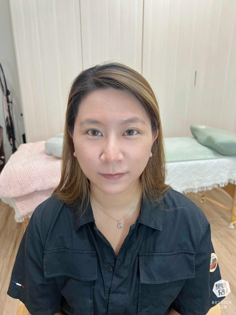 【醫美】高雄埋線拉提推薦｜想要臉部緊實-MINT秘特拉提線 心得過程！高雄仲夏醫美診所