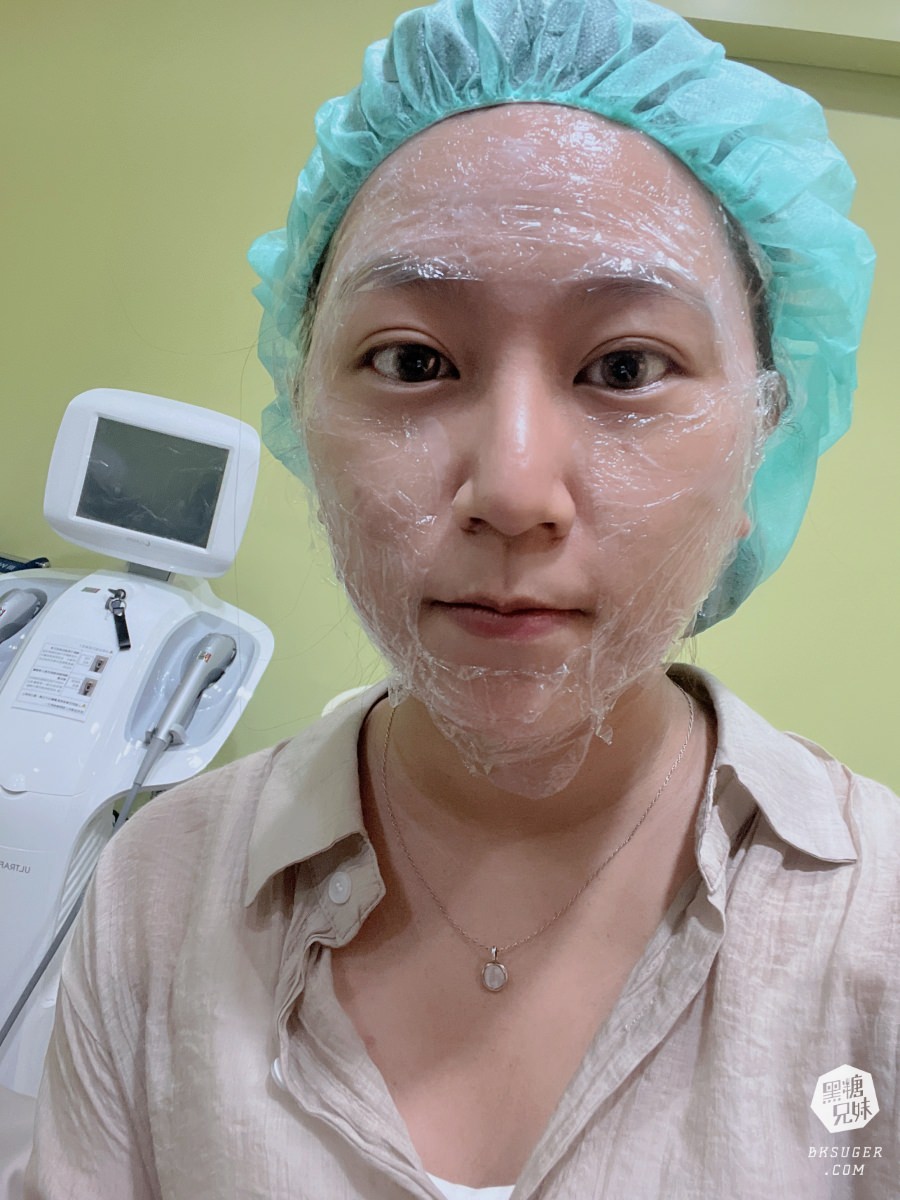 【醫美】高雄埋線拉提推薦｜想要臉部緊實-MINT秘特拉提線 心得過程！高雄仲夏醫美診所