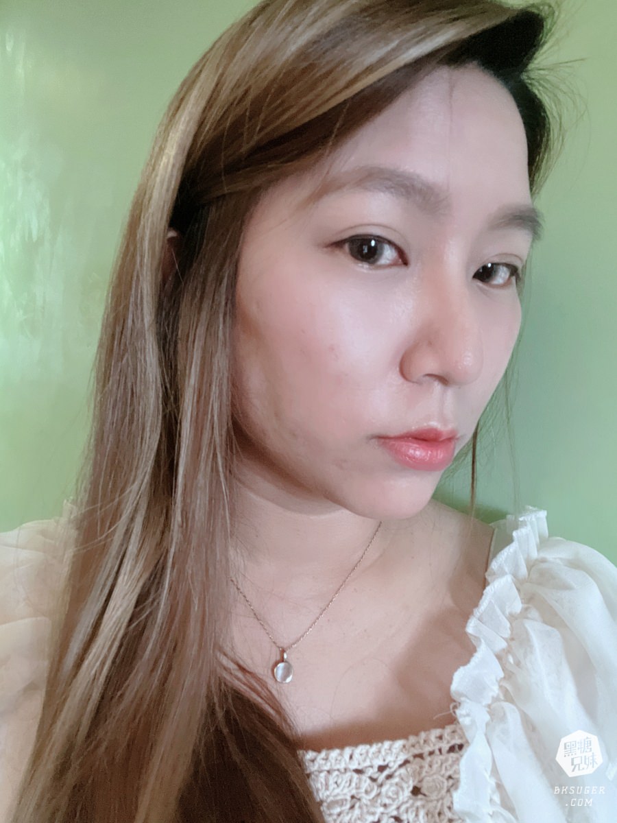 【醫美】高雄埋線拉提推薦｜想要臉部緊實-MINT秘特拉提線 心得過程！高雄仲夏醫美診所