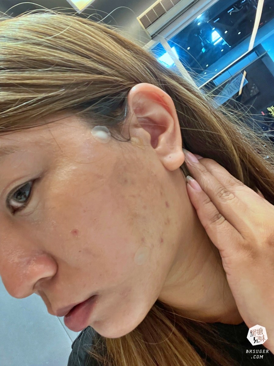 【醫美】高雄埋線拉提推薦｜想要臉部緊實-MINT秘特拉提線 心得過程！高雄仲夏醫美診所