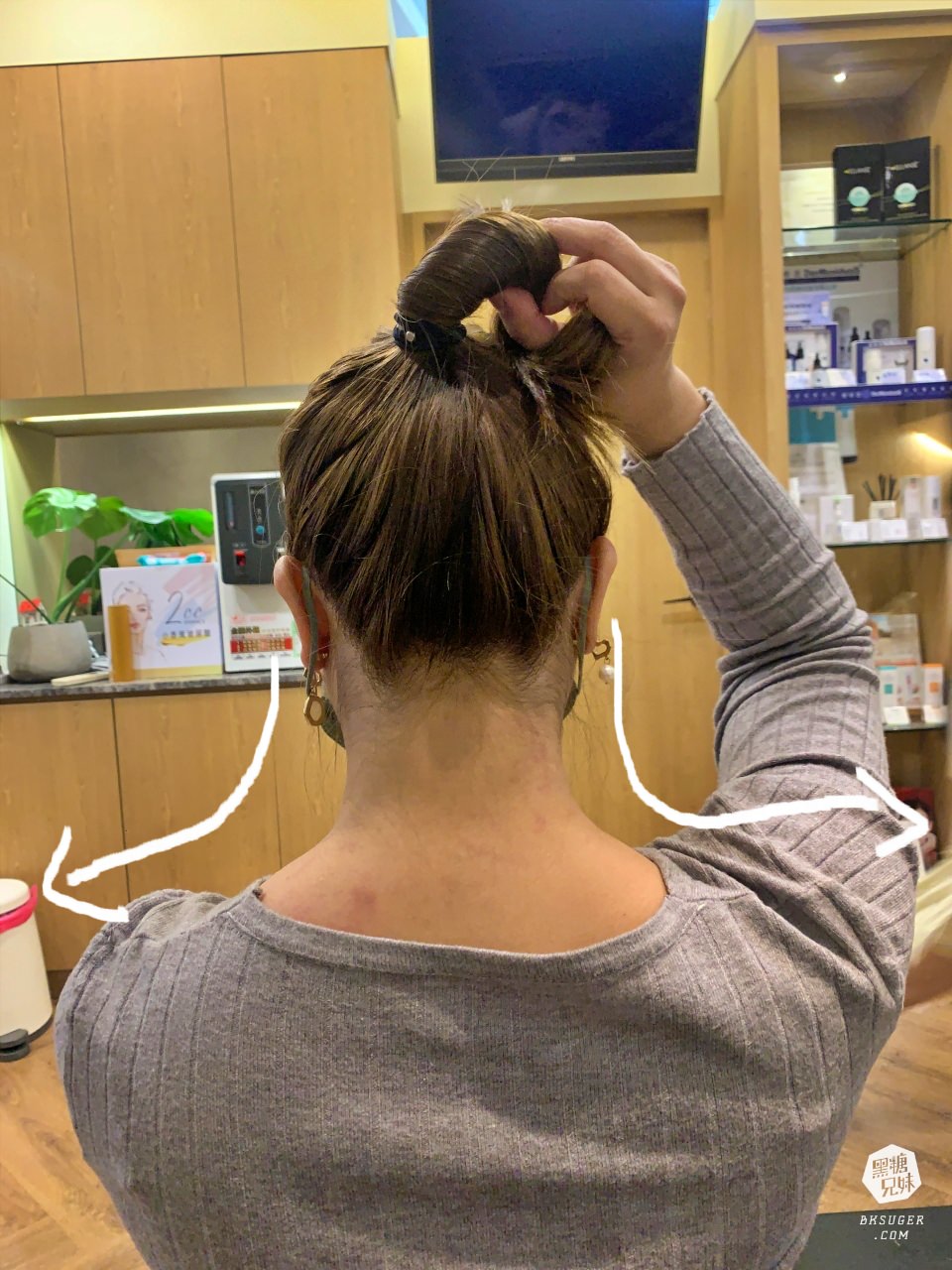 高雄肉毒推薦|輕齡肉毒Letybo保提拉-天鵝頸肉毒肩膀、肉毒小腿|綻美時尚診所張勝捷醫師 - 第12張圖 高雄肉毒推薦|輕齡肉毒Letybo保提拉-天鵝頸肉毒肩膀、肉毒小腿|綻美時尚診所張勝捷醫師