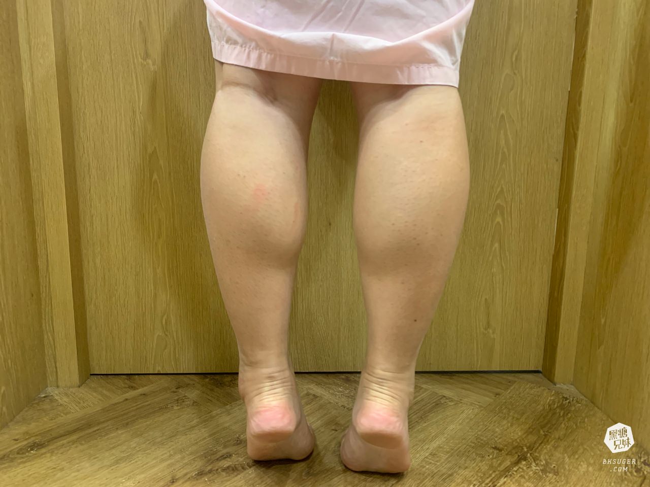 高雄肉毒推薦|輕齡肉毒Letybo保提拉-天鵝頸肉毒肩膀、肉毒小腿|綻美時尚診所張勝捷醫師 - 第16張圖 高雄肉毒推薦|輕齡肉毒Letybo保提拉-天鵝頸肉毒肩膀、肉毒小腿|綻美時尚診所張勝捷醫師