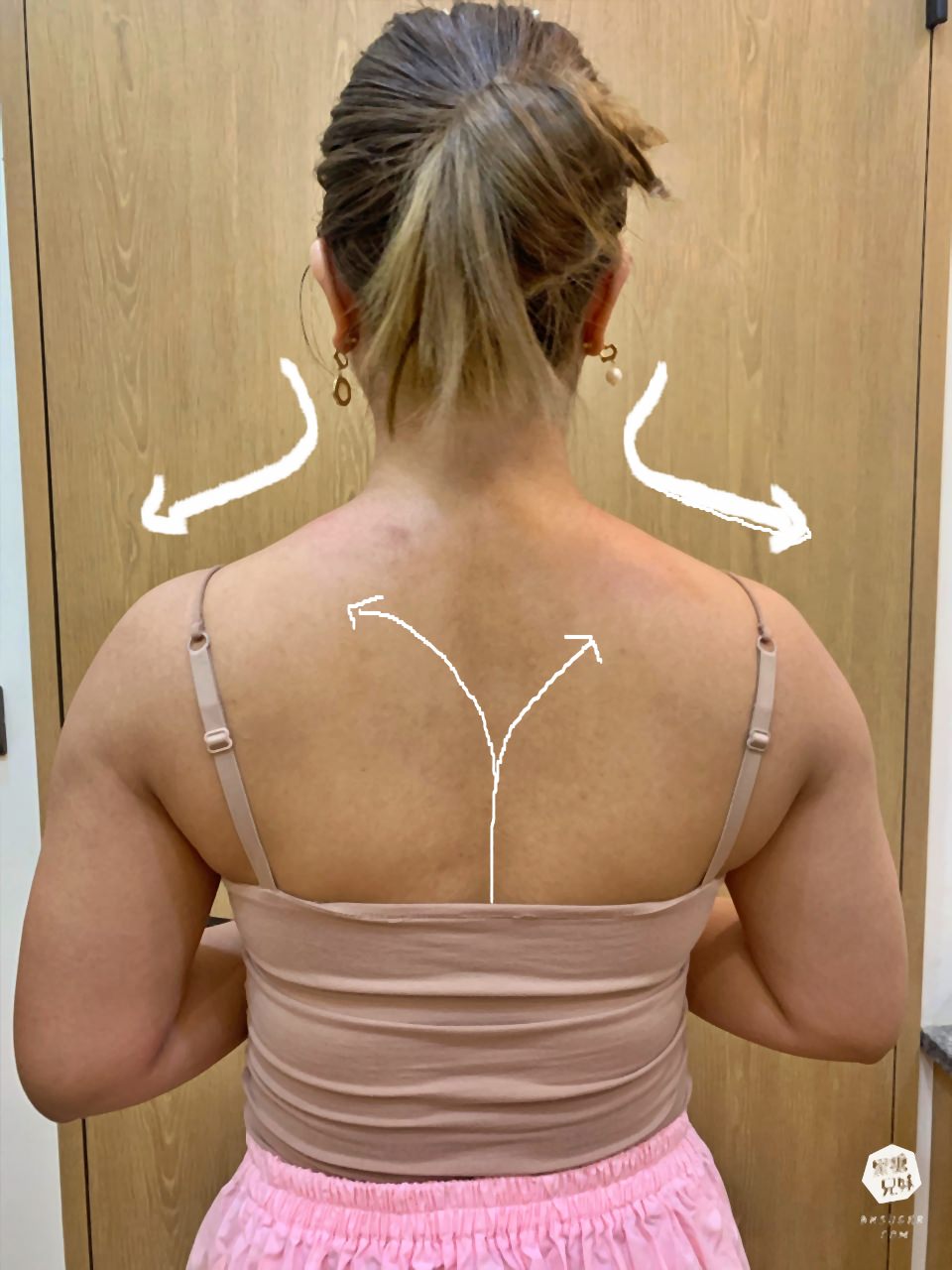 高雄肉毒推薦|輕齡肉毒Letybo保提拉-天鵝頸肉毒肩膀、肉毒小腿|綻美時尚診所張勝捷醫師 - 第13張圖 高雄肉毒推薦|輕齡肉毒Letybo保提拉-天鵝頸肉毒肩膀、肉毒小腿|綻美時尚診所張勝捷醫師