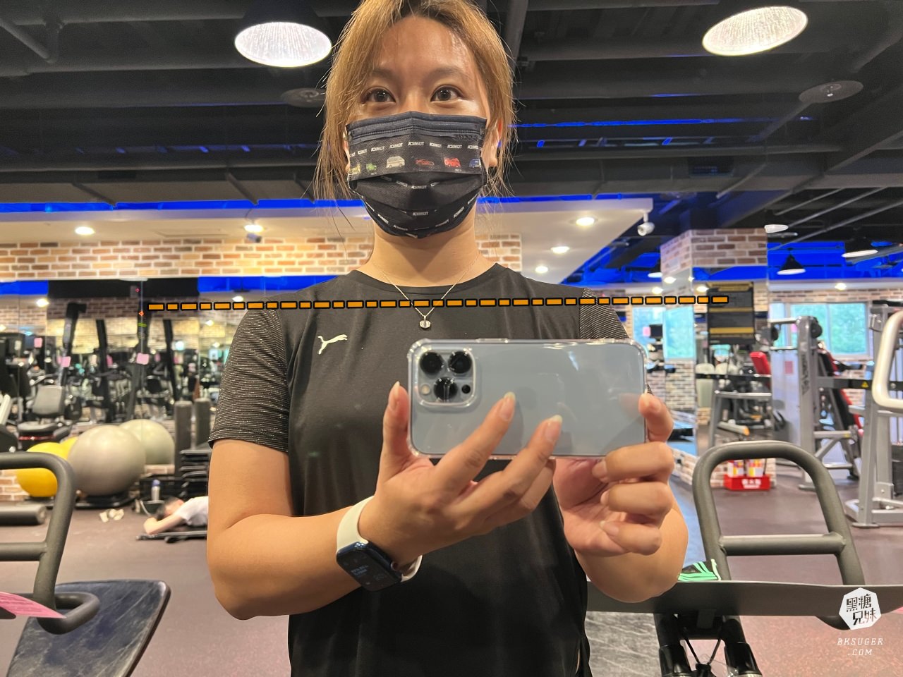 高雄肉毒推薦|輕齡肉毒Letybo保提拉-天鵝頸肉毒肩膀、肉毒小腿|綻美時尚診所張勝捷醫師 - 第21張圖 高雄肉毒推薦|輕齡肉毒Letybo保提拉-天鵝頸肉毒肩膀、肉毒小腿|綻美時尚診所張勝捷醫師