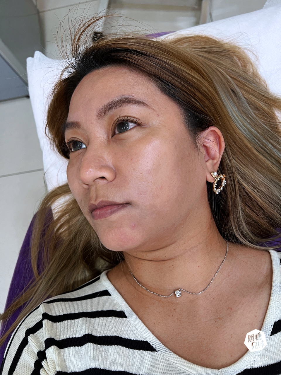 美美上美診所|台南醫美推薦-蔡宗賢醫師|海菲秀Hydrafacial、4D PicoPlus 蜂巢皮秒 - 第23張圖 美美上美診所|台南醫美推薦-蔡宗賢醫師|海菲秀Hydrafacial、4D PicoPlus 蜂巢皮秒