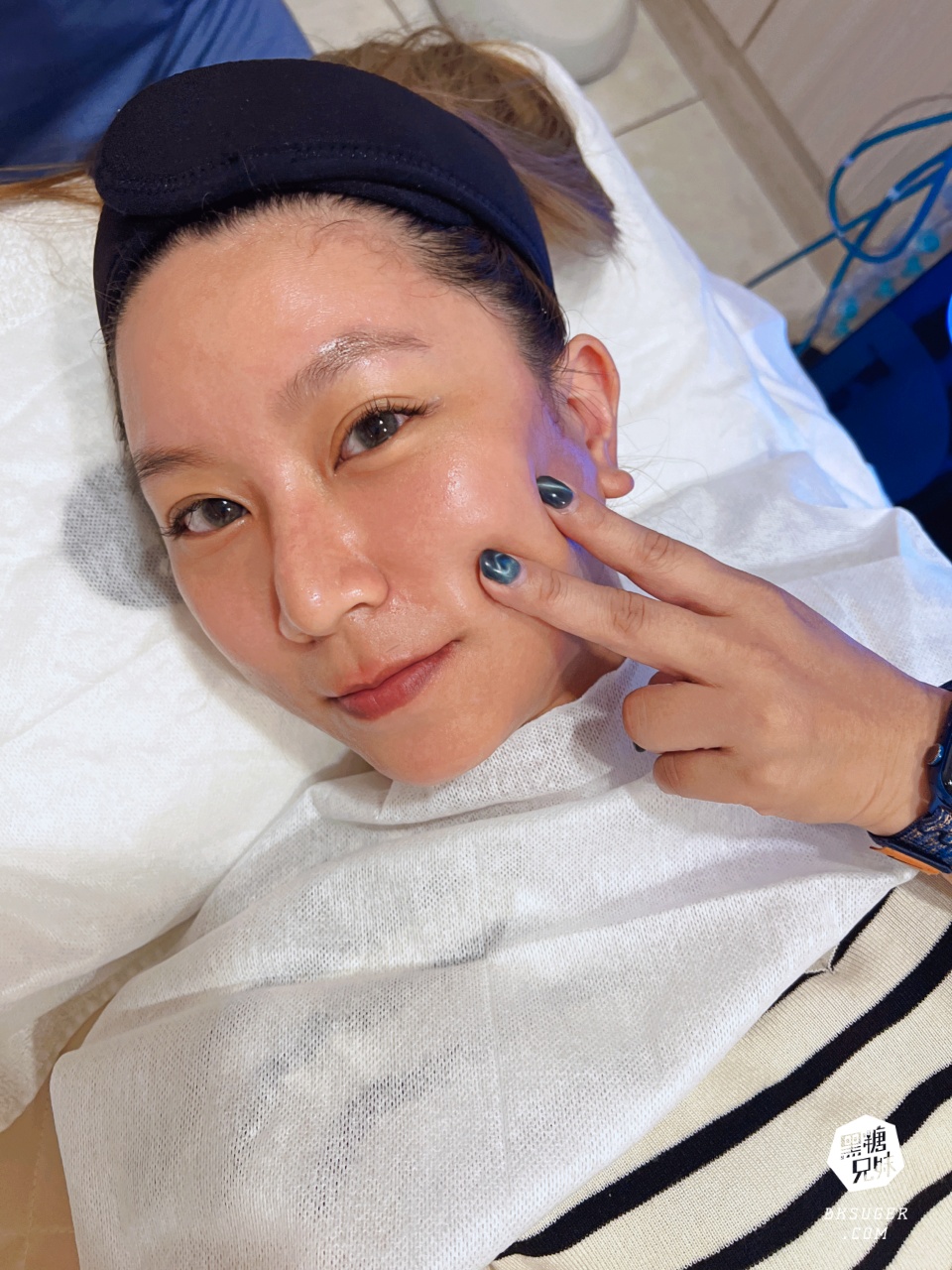 美美上美診所|台南醫美推薦-蔡宗賢醫師|海菲秀Hydrafacial、4D PicoPlus 蜂巢皮秒 - 第20張圖 美美上美診所|台南醫美推薦-蔡宗賢醫師|海菲秀Hydrafacial、4D PicoPlus 蜂巢皮秒