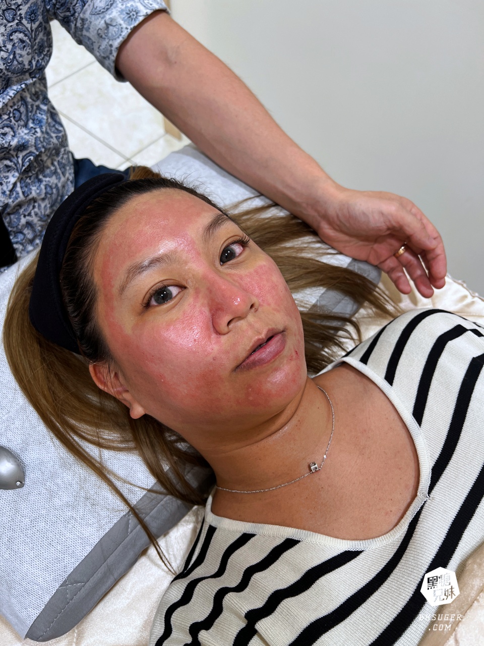 美美上美診所|台南醫美推薦-蔡宗賢醫師|海菲秀Hydrafacial、4D PicoPlus 蜂巢皮秒 - 第28張圖 美美上美診所|台南醫美推薦-蔡宗賢醫師|海菲秀Hydrafacial、4D PicoPlus 蜂巢皮秒