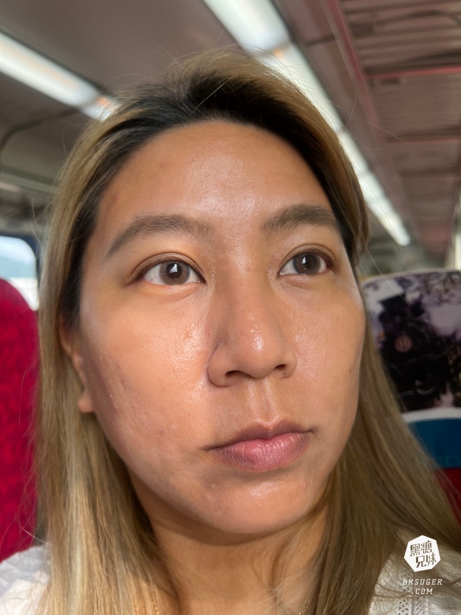 CAPRI藍雷射初體驗心得|狂出油膩肌&爆痘2024抗痘新選擇|台中日曦美學診所-豐原醫美推薦 - 第3張圖 CAPRI藍雷射初體驗心得|狂出油膩肌&爆痘2024抗痘新選擇|台中日曦美學診所-豐原醫美推薦