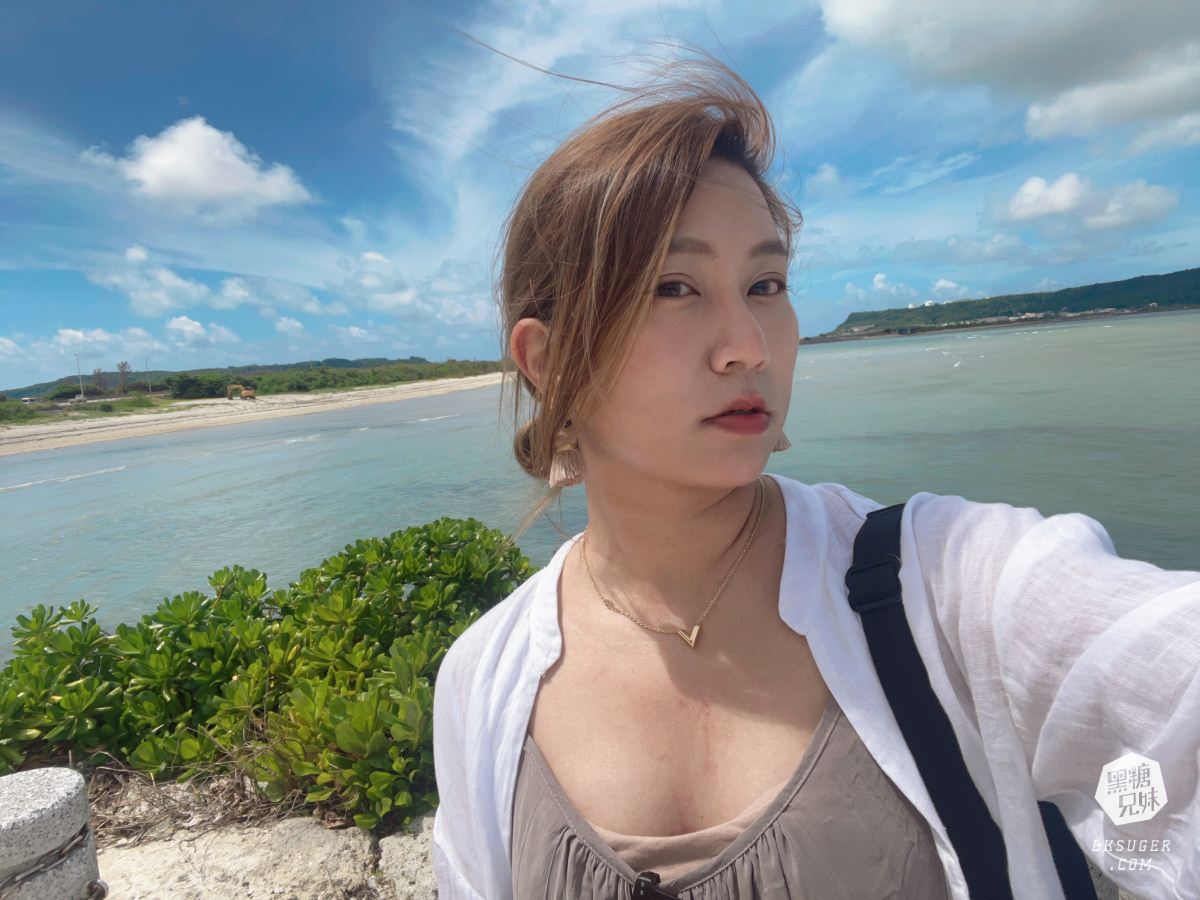 SOFWAVE索夫波|梁詠琪代言-美妙輪廓30+齡偷偷美起來|佳思優整形外科美學診所-台中分院 - 第20張圖 SOFWAVE索夫波|梁詠琪代言-美妙輪廓30+齡偷偷美起來|佳思優整形外科美學診所-台中分院