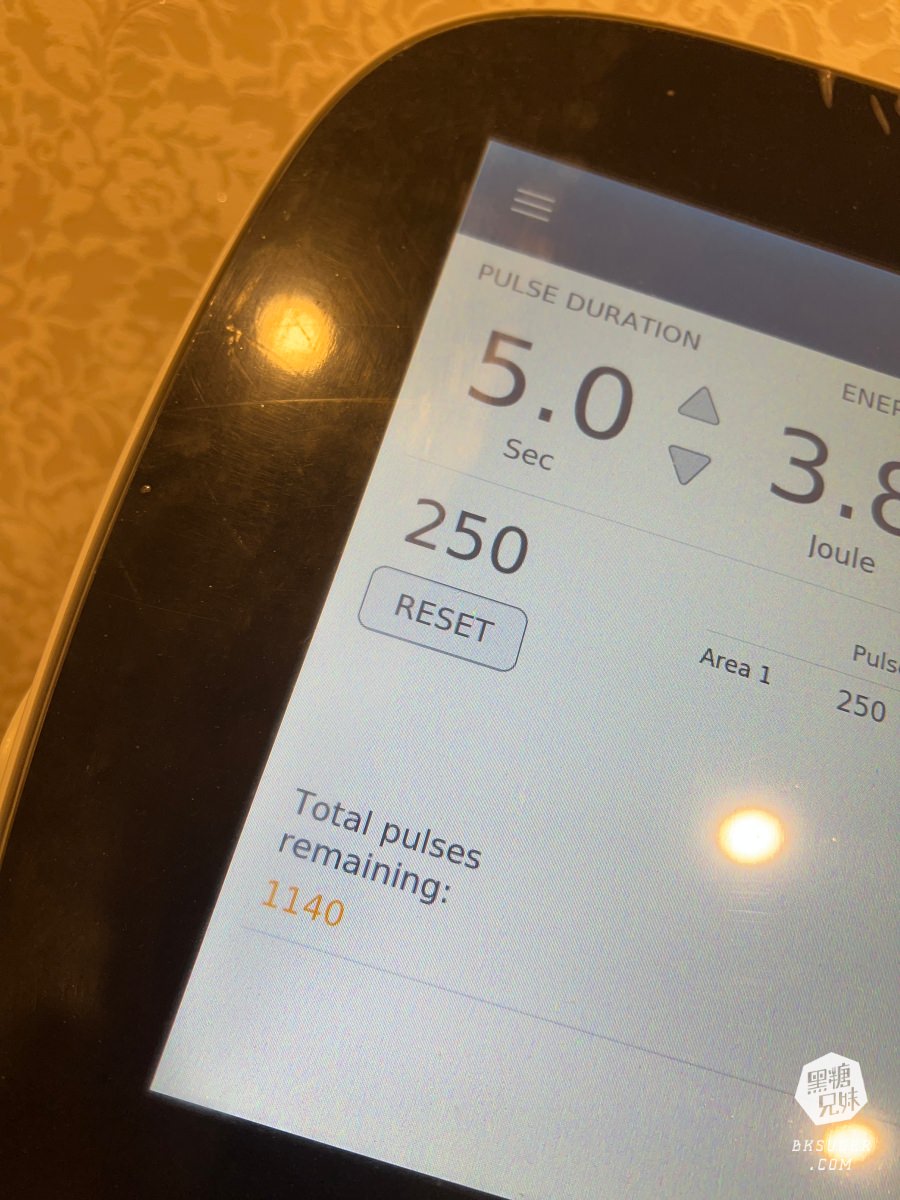 SOFWAVE索夫波|梁詠琪代言-美妙輪廓30+齡偷偷美起來|佳思優整形外科美學診所-台中分院 - 第12張圖 SOFWAVE索夫波|梁詠琪代言-美妙輪廓30+齡偷偷美起來|佳思優整形外科美學診所-台中分院