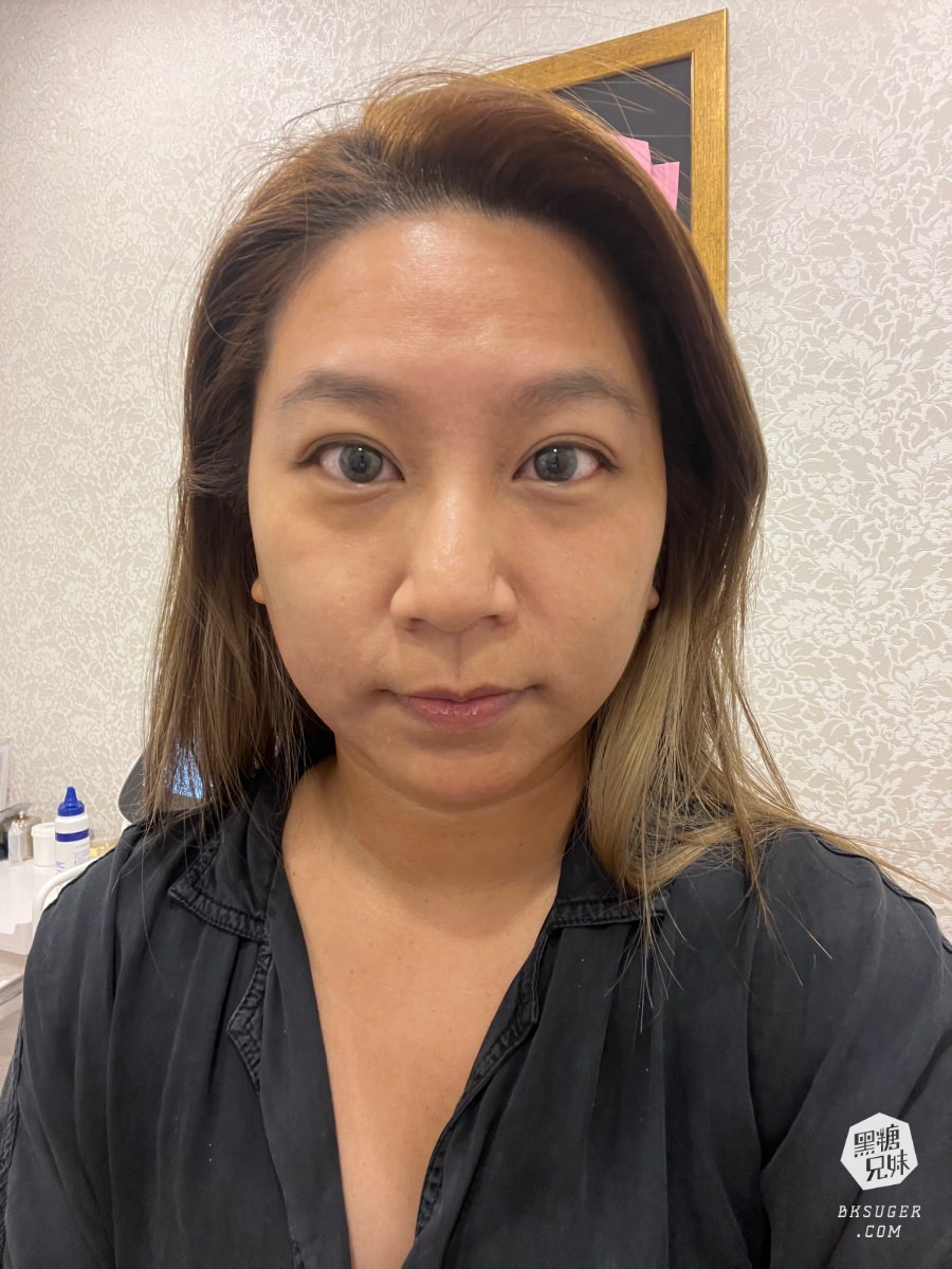 SOFWAVE索夫波|梁詠琪代言-美妙輪廓30+齡偷偷美起來|佳思優整形外科美學診所-台中分院 - 第15張圖 SOFWAVE索夫波|梁詠琪代言-美妙輪廓30+齡偷偷美起來|佳思優整形外科美學診所-台中分院